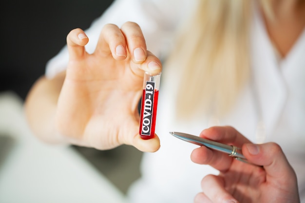 Doctor holds test tube with covid-19 test