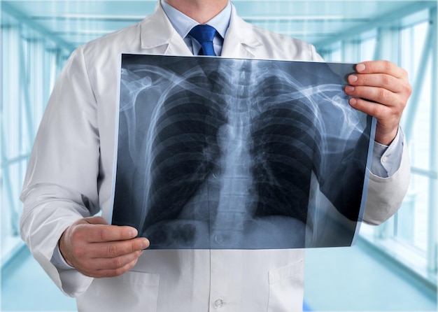 Doctor looking chest x-ray film in hospital.