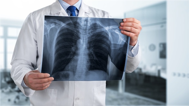 Doctor looking chest x-ray film in hospital.