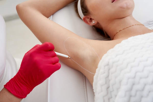 Doctor makes injections of botulinum toxin in the underarm area against hyperhidrosis in beauty