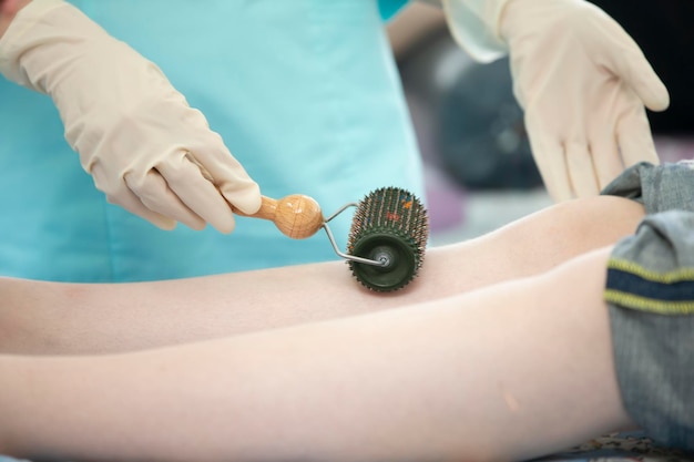 The doctor makes the patient acupuncture and vacuum massage