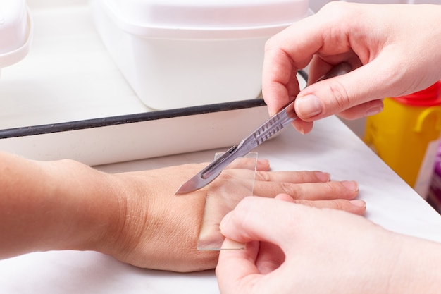 The doctor makes a scraping from the patient's skin. Close-up.