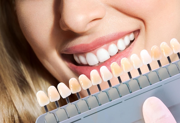 Doctor matching patients teeth color with palette closeup cosmetic dentistry