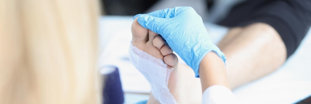 Doctor in medical gloves examines the patient leg osteophytes and paroxysmal pain in foot