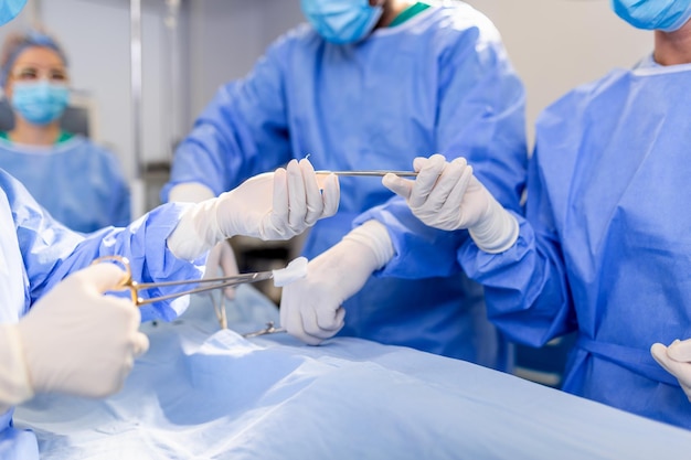 Doctor and nurse medical team are performing surgical operation at emergency room in hospital assistant hands out scissor and instruments to surgeons during operation