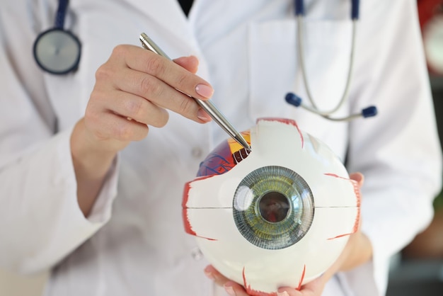 Doctor ophthalmologist holding human eye anatomical model and pointing by pen