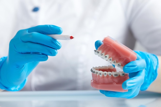 Doctor orthodontist showing model of human jaw with wire braces attached