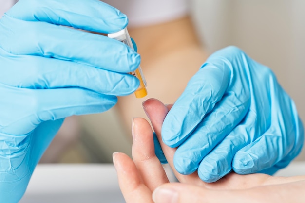 Doctor piercing patients finger with lancet in clinic closeup taking blood for closeup analysis a cl