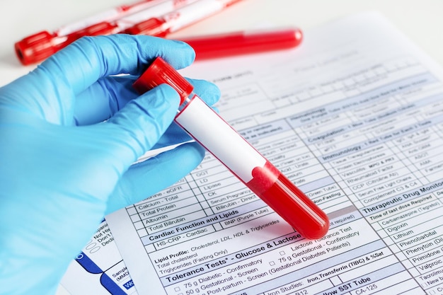 Doctor's hand holding red blood vial with blood sample and filling test form with results