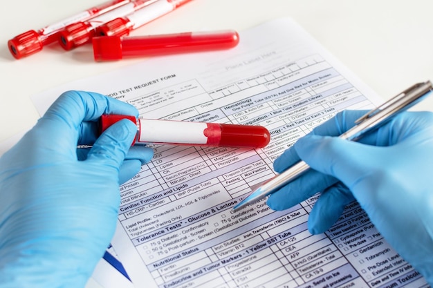 Doctor's hand holding red blood vial with blood sample and filling test form with results