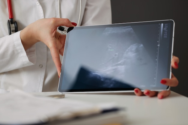 Doctor showing abdominal ultrasound scan on digital tablet in clinic closeup