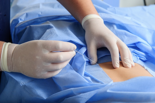 Doctor during suture wound in operating room.