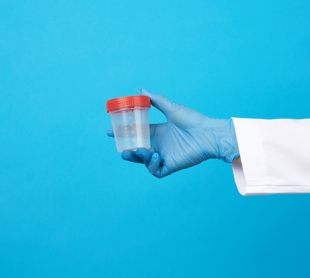 Doctor in a white coat holds a empty plastic container for urine specimen