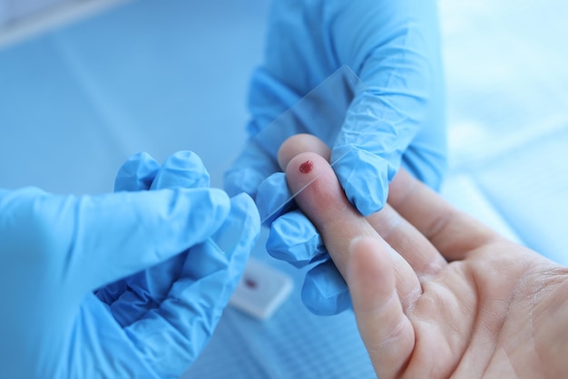 Doctor with blood sample on glass in laboratory closeup Blood test general biochemical immunological concept