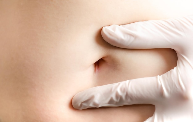 Doctor with white gloves pointing at caucasian womans abdomen scar from laparoscopic surgery