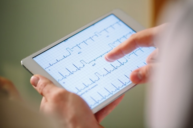 Doctors discussing patient's cardiogram on the tablet.