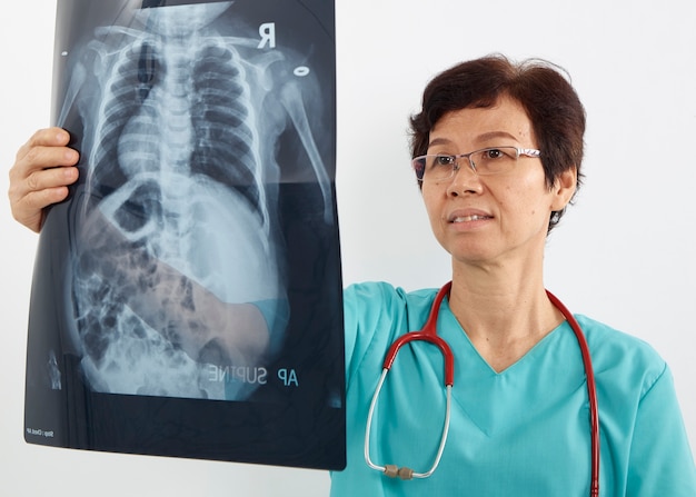 Doctors examining x-ray of chest