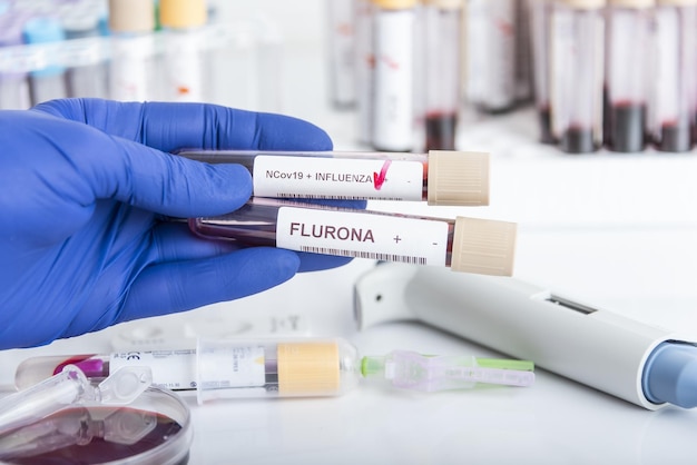 Doctors hands hold blood samples of the new variant omicron plus flu flurona covid coronavirus