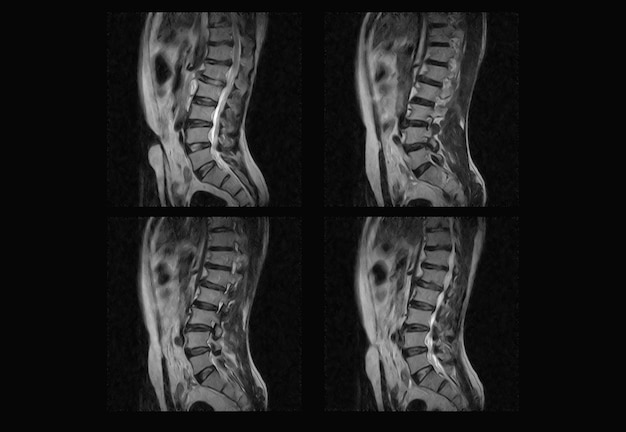 Dorsal Spine MRI and ct scan professional xray images