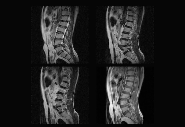 Dorsal Spine MRI and ct scan professional xray images