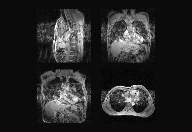 Dorsal Spine MRI and ct scan professional xray images