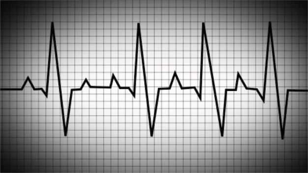 ECG monitoring Black and white glowing neon heart pulse Heart beat Electrocardiogram Black and white glowing neon heart pulse illustration Chest pain ECG EKG Medical health care