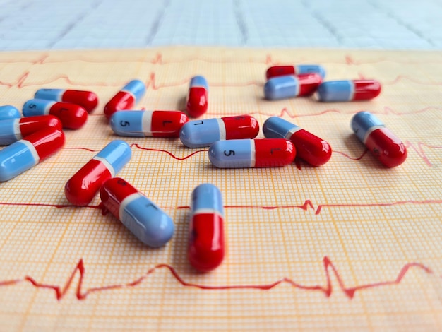 ECG with ventricular pacing rhythm of artificial pacemaker with pills on table