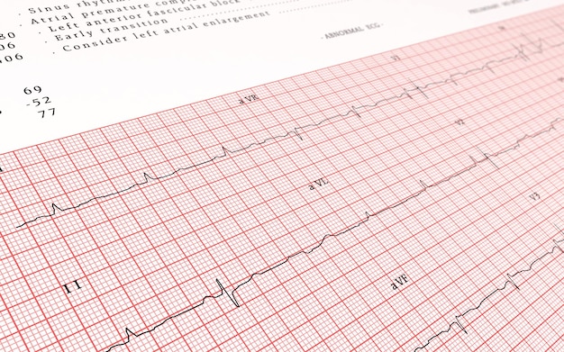 Ekg graphic render (depth of field)