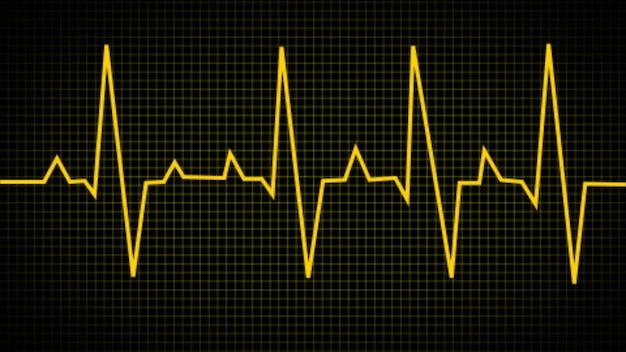 Ekg monitoring Yellow glowing neon heart pulse Heart beat Electrocardiogram Red glowing neon heart pulse illustration Chest pain ECG EKG Medical health care