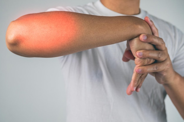 Elbow injury from tennis and golf The man uses fingers to massage and stretch his arm Pain symptom area is shown with red color Healthcare knowledge Medium close up shot