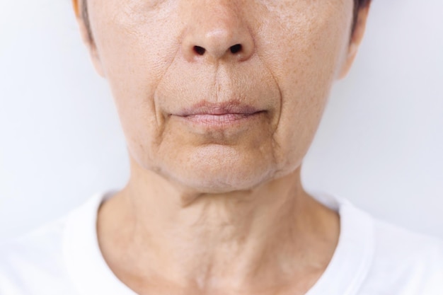 Photo elderly caucasian woman face and neck with signs of skin aging flabby saggy facial skin wrinkles