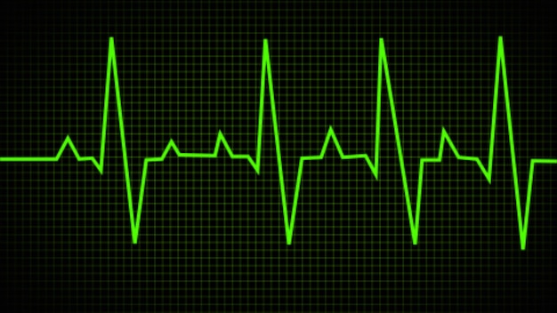 Electrocardiogram Heartbeat line Pulse trace ECG or EKG Cardio graph symbol for Healthy and Medical