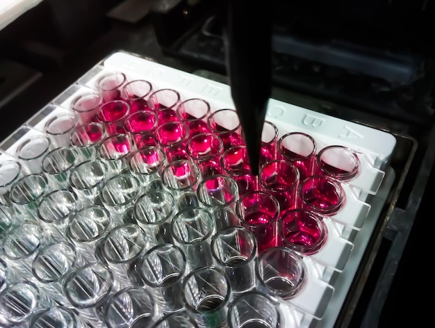 ELISA or Enzyme Linked immunosorbent assay plate