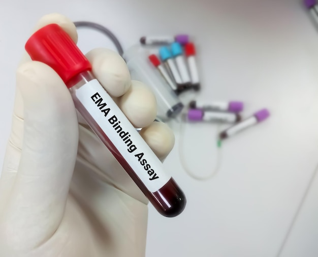 EMA binding assay test or a flow cytometric test widely used to detect hereditary spherocytosis