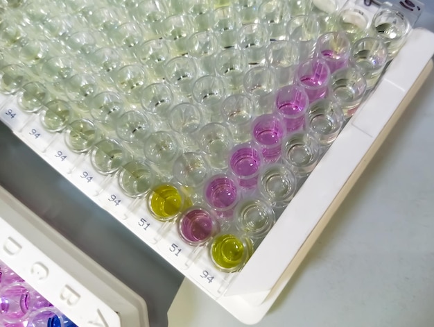 Enzyme Linked Immunosorbent Assay or ELISA plate