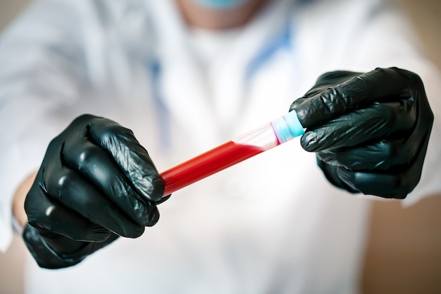 The epidemic of coronavirus. Hand of a doctor holding a bottle of blood sample.