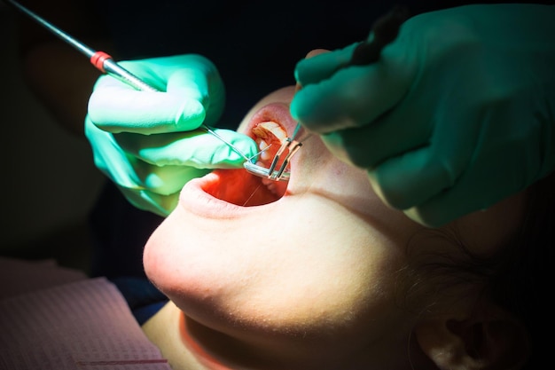 Photo european female patient on dentist appointment during dental procedure