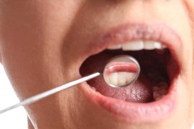 Examining patient's gums on white background closeup view