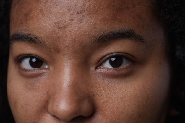 Extreme close up portrait of real African American woman looking at camera with focus on skin imperfections