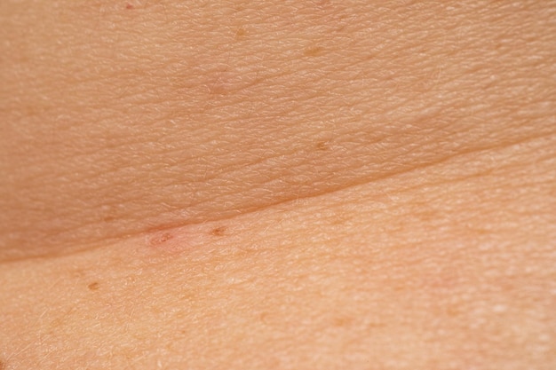 Extreme closeup of human skin Suitable as background texture for copy