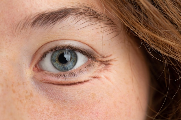 Eye bags close up on woman face