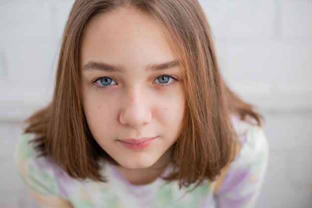 Face of a teenage girl in close up. Teen with problematic skin. Girl with a square hairstyle. Acne and scars. Natural portrait. No makeup and retouch. High quality photo