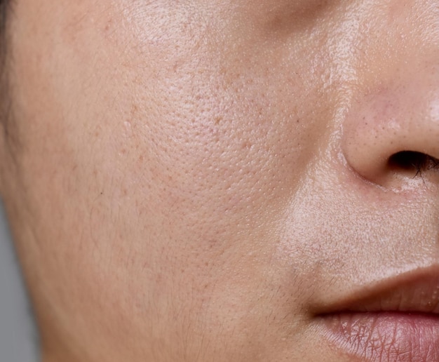 Fair skin with wide pores in face of Southeast Asian Myanmar or Korean adult young man