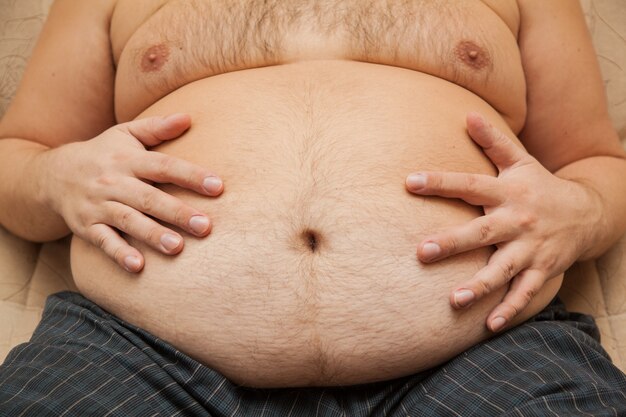 Fat belly of an obese man. The consequences of malnutrition