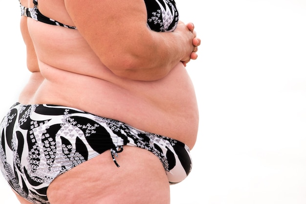 Fat body isolated side view of obese woman health in serious danger aftermath of constant overeating