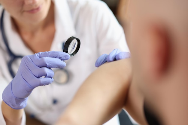 Female dermatologist examining patient skin with magnifying glass at consultation in hospital