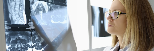 Female doctor examines an X-ray in medical office. Medical care and services concept