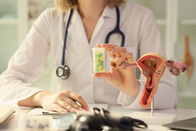 Female gynecologist shows medical pills and model of female reproductive system concept of