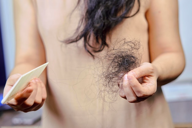 Female hairloss problems