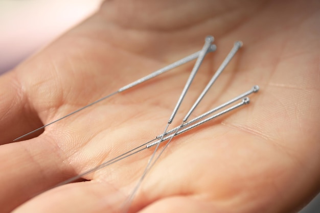 Female hand with needles for acupuncture closeup